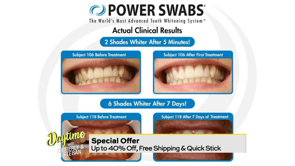 Power Swabs: The perfect time for a whiter smile is NOW