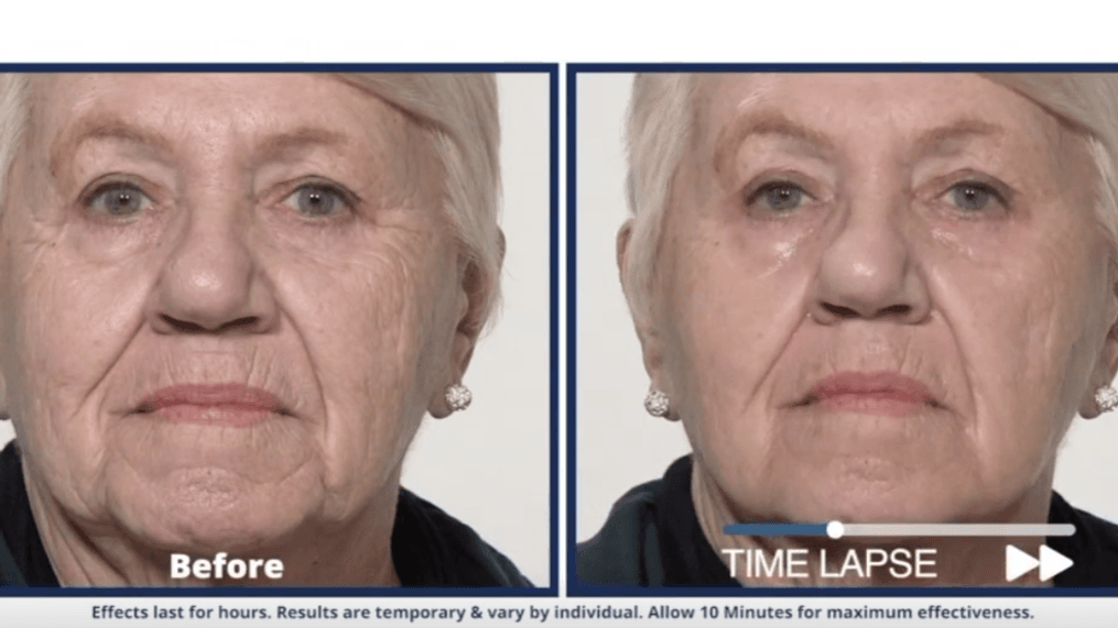 Daytime-Look younger with Plexaderm! 