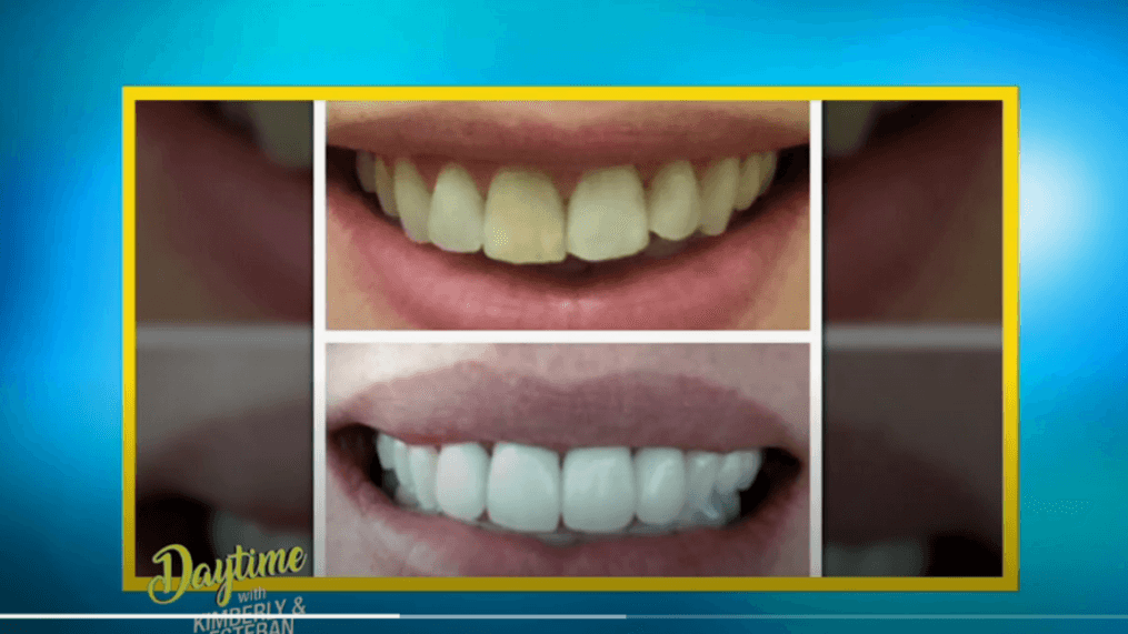 Daytime- Affordable dental and braces