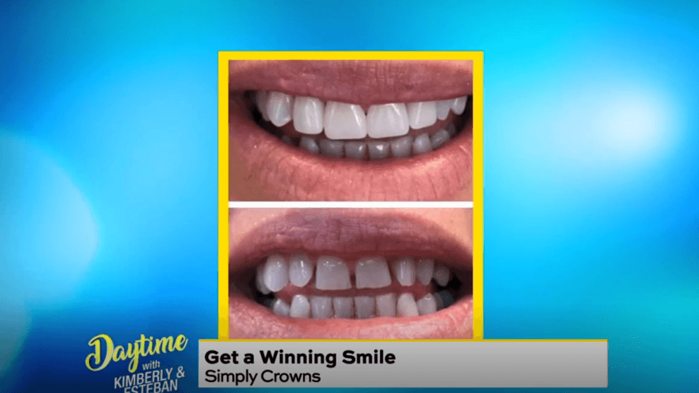 Daytime - A perfect smile | Simply Crowns
