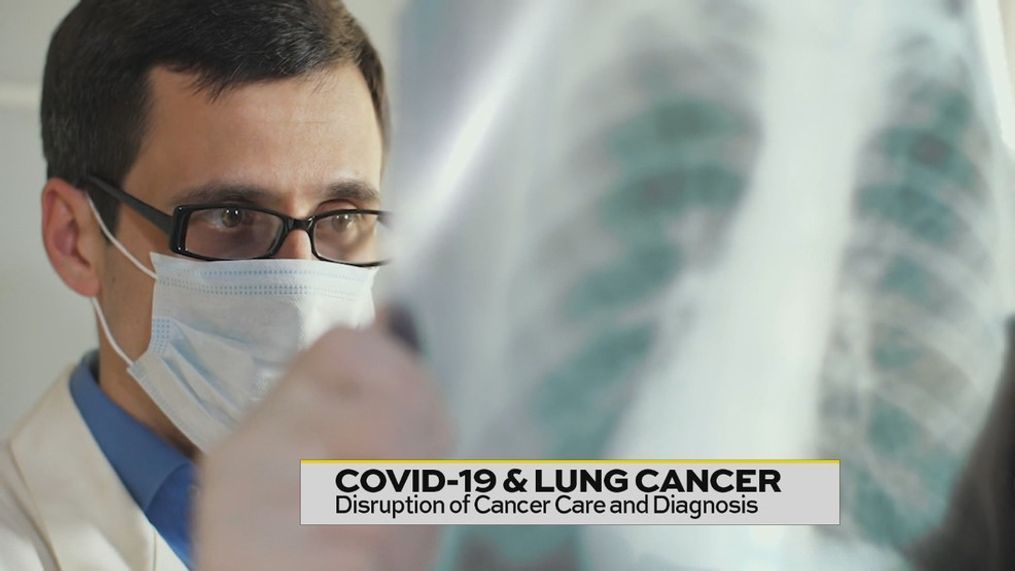 Covid-19 & Lung Cancer