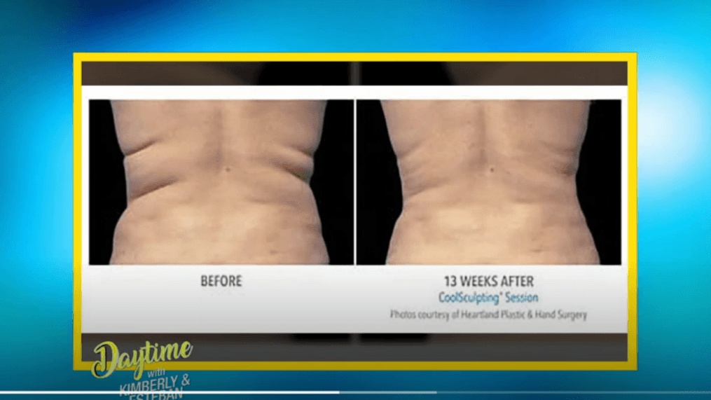 Daytime - Quick and painless way to lose weight