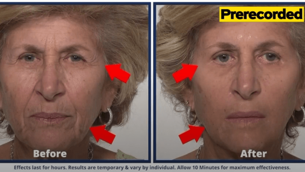 Daytime- Plexaderm: Real and Fast Results