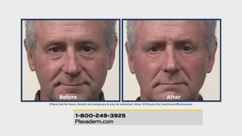 Plexaderm Rapid Reduction Serum is a powerful anti-aging cream that can almost instantly take years off your appearance. (Photo courtesy Plexaderm.com)