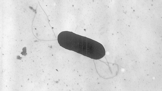 FILE - This 2002 electron microscope image made available by the Centers for Disease Control and Prevention shows a Listeria monocytogenes bacterium, responsible for the food borne illness listeriosis. (Elizabeth White/CDC via AP, File)