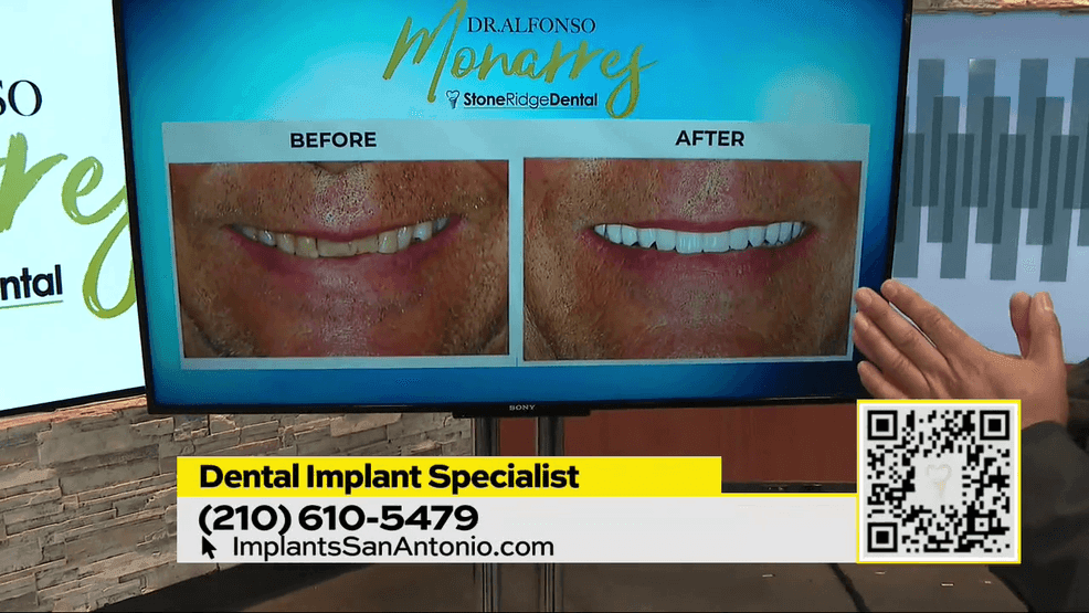 Image for story: Stone Ridge Dental - Give your Smile some TLC