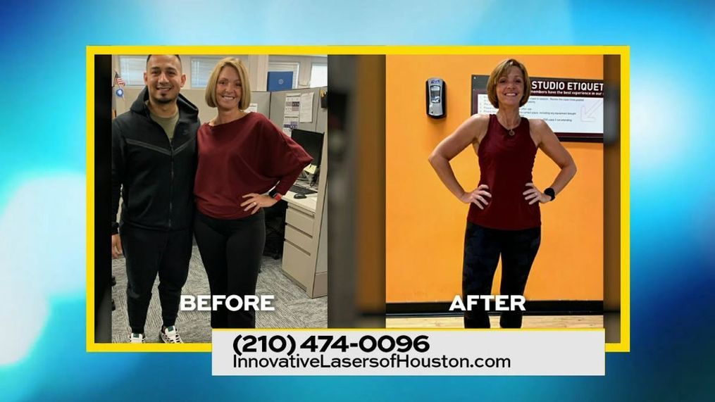Look Your Best with Innovative Lasers of Houston