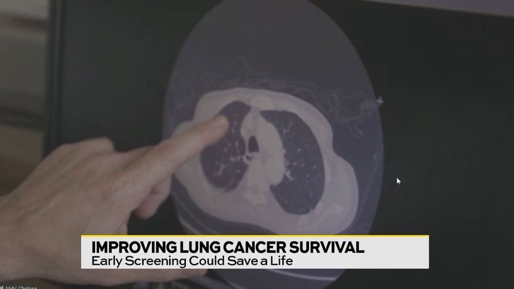 Improving Lung Cancer Survival