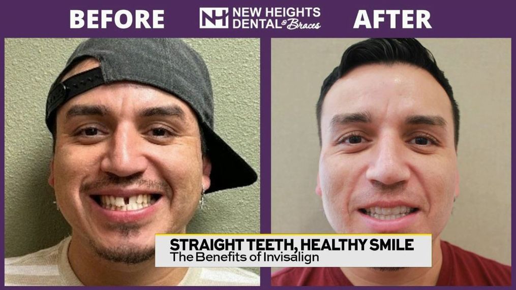 A New Smile with New Heights Dental and Braces