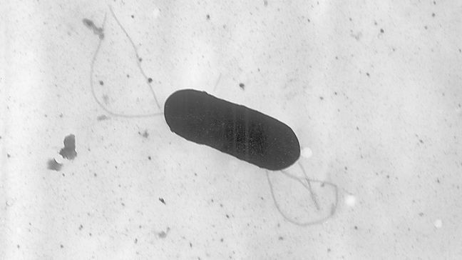 FILE - This 2002 electron microscope image made available by the Centers for Disease Control and Prevention shows a Listeria monocytogenes bacterium, responsible for the food borne illness listeriosis. (Elizabeth White/CDC via AP, File)