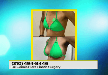 Image for story: Breast Augmentation with Dr. Connie Hiers